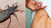 Beware of “Kissing Bugs” They May Sound Cute But They Are Actually Dangerous