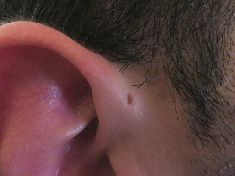 Phantom Earring Holes
